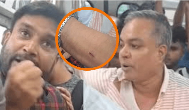 One passenger was bitten by another on the metro rail