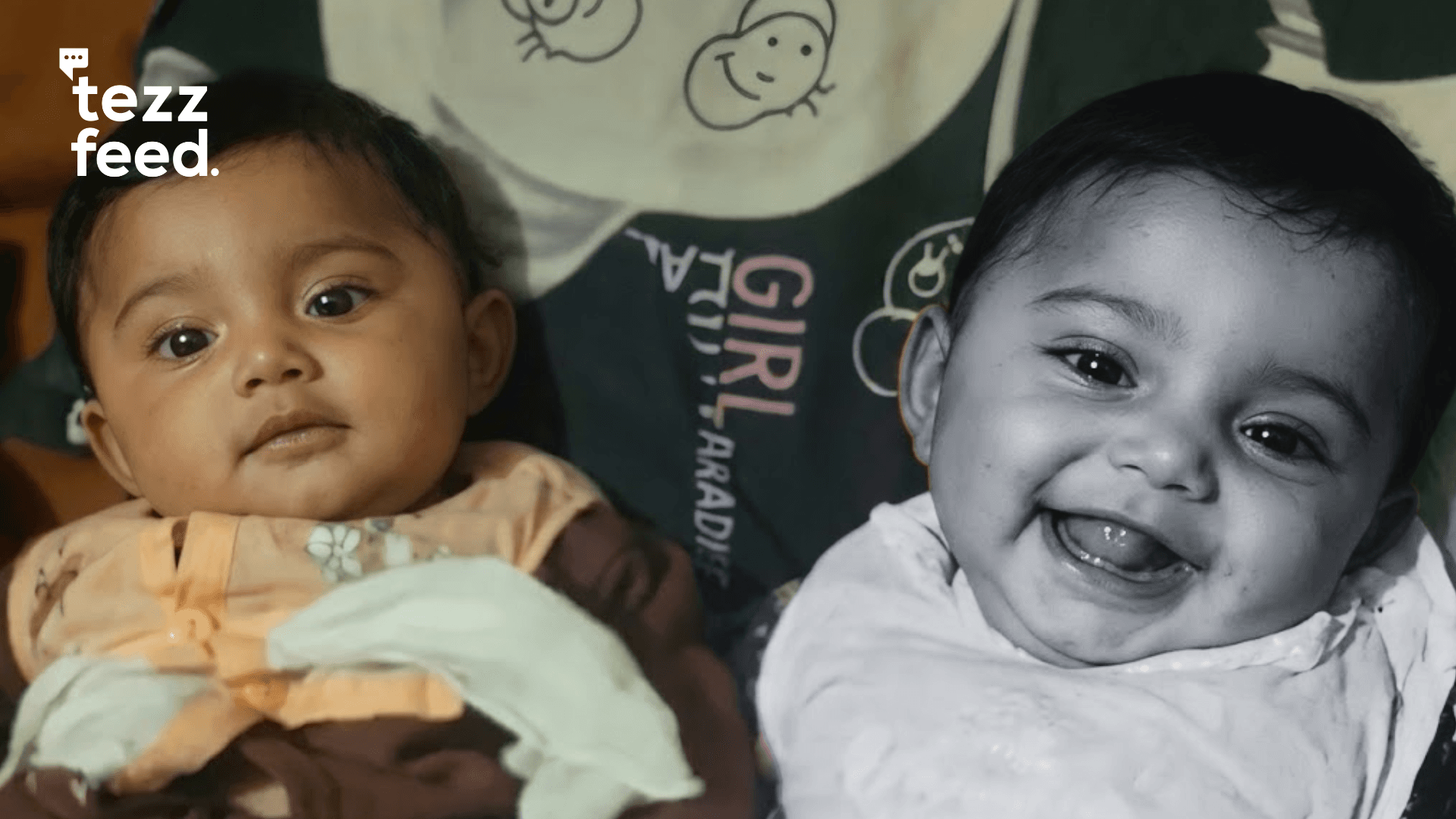 7-Month-Old Twins Hit by Measles: Fatema Dies, Khadija Still Fighting