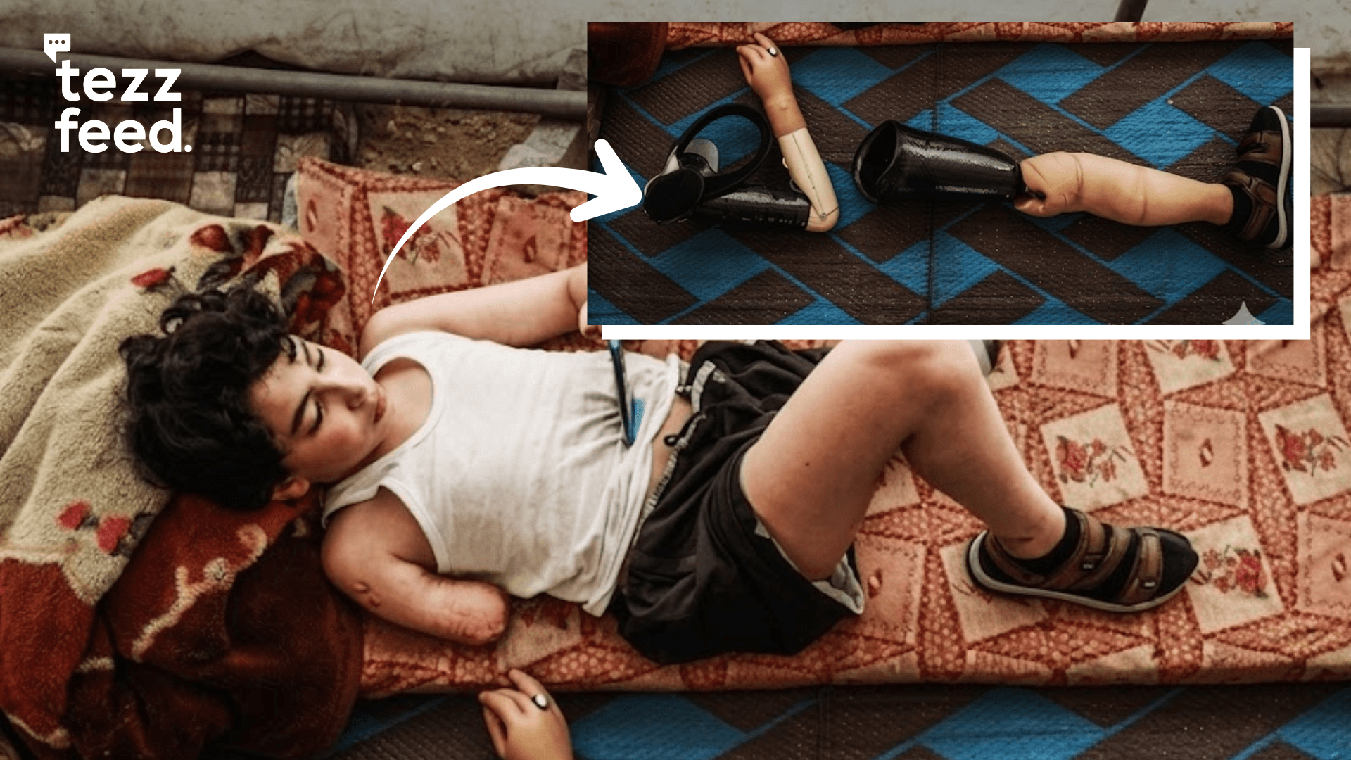 12-Year-Old Samir Becomes First Child to Return to Gaza With Prosthetic Limbs After Jordan Treatment